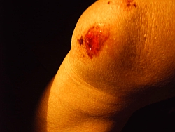 Knie
