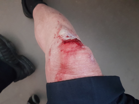 knee